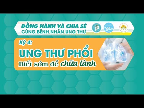 Kỳ 4: Ung thư phổi biết sớm để chữa lành