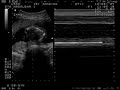 Ultra Sonografia Matheus Kathriel 2 Ultra Sonografia Matheus Kathriel 2