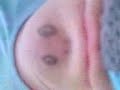Danish version of chin face