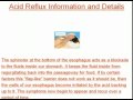 Acid Reflux Information and Details