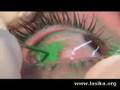 Eyeball Tatoo @ www.lasika.org