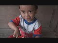 bukol,World,Vision