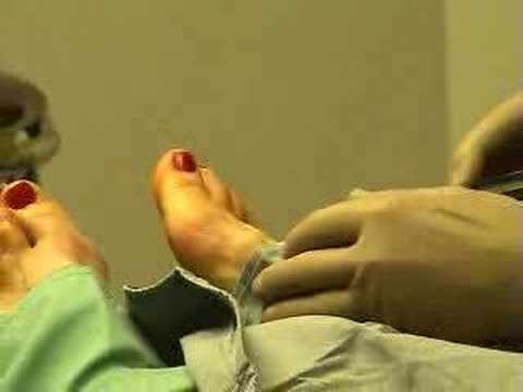 old lady bunions