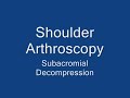 Arthroscopy: Subacromial Decompression by Ford Qureshi