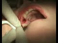 Immediate video