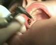 Immediate video