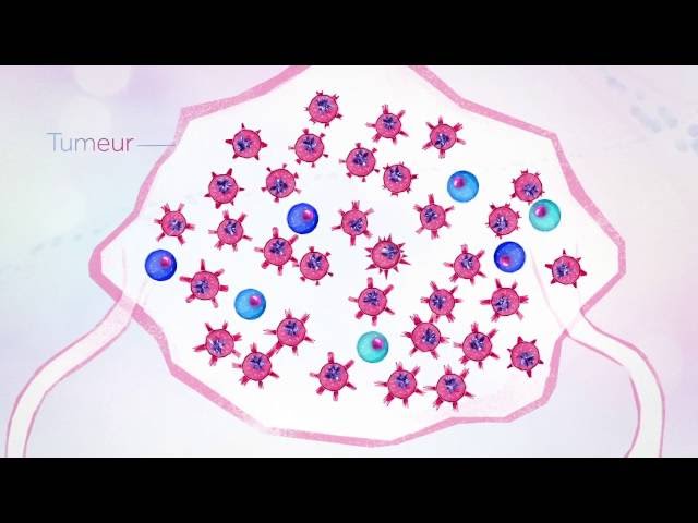 Qu'est-ce que le cancer?