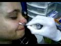 Piercing da Reeh 2 Piercing da Reeh 2