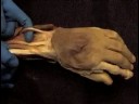 Hand39 Hand39