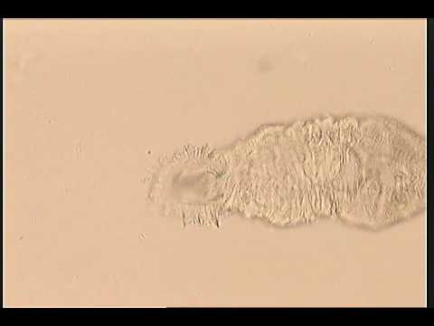 Microscopic Predators