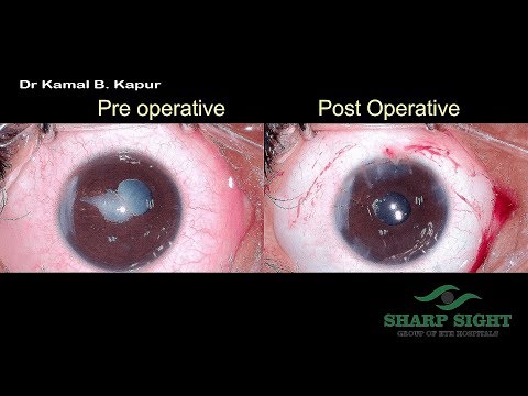 Dog cataract surgery cost image