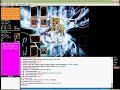 YDM - M. Clown Vs Sadalsud (YuGiOh! BraSil) YDM - M. Clown Vs Sadalsud (YuGiOh! BraSil)