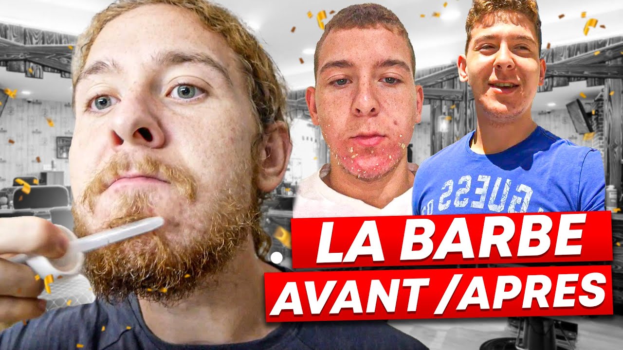 Faire pousser sa barbe rapidement 🧔🏼‍♂️ | le minoxidil marche vraiment! ✅