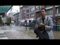 Hair Transplant | \"Darren\