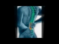 Tempe, AZ Back Pain Relief - Dr. Bruce Lubitz