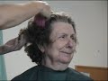 A Face of Alzheimers A Face of Alzheimers