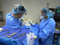 Silicone Breast Augmentation B cup to a D cup & Rhinoplasty Nose Job