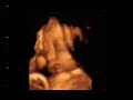 Carita a las 36 semanas Carita a las 36 semanas