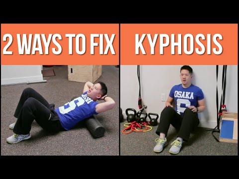 how to cure postural kyphosis