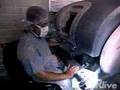 Robotic Cardiac Bypass Surgery