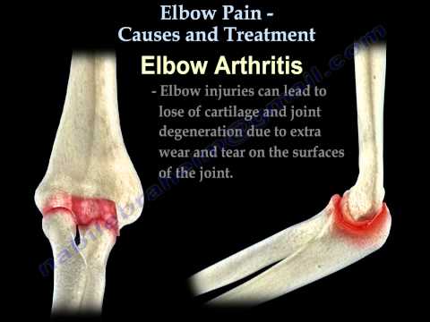 how to relieve elbow joint pain