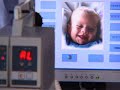 Hadassah's IVF Unit offers all of the standard and advanced fertility tests and treatments available in the field today. Among the procedures offered at Hadassah are IVF (in-vitro fertilization), GIFT (gamete intra-fallopian transfer), laser assisted hatching, embryo freezing, and ICSI (intracytoplasmic sperm injection). The treatment cycle lasts for about one month. Some tests can be performed, and the treatment can be started, in your own country as long as there is a gynecologist who can help you with the instruction. Conversely, you can come to Jerusalem and get the entire test and treatment cycle at Hadassah.