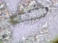 demodex vivo buldog ingles.AVI
