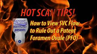 Mastering the Subcostal Window