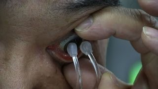 【ソフトコンタクトレンズのつけはずしが苦手な方に朗報】世界初!指を使わずにレンズのつけはずしができる「meruru」(日本語&英語)(2分)