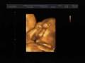 videos de Baby Woo Ultrasound part 1.wmv