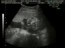Ultra do meu filho Cauã