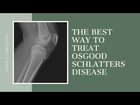 how to treat osgood schlatter