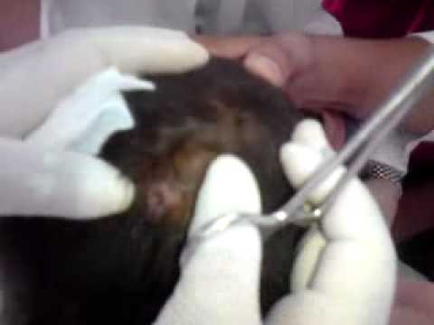 Gusano en la cabeza de un niño. A worm in the head of a boy