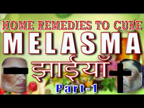 how to care melasma