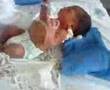 Avaliação - Terapia Ocupacional na Pediatria