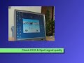 Telemedicine with Bluetooth + GPRS - Dyna-Vision ECG & SpO2