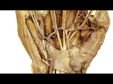 how to cure rheumatoid arthritis permanently