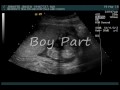 Zaide,Ultrasound,Vid