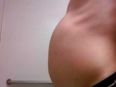 belly distension