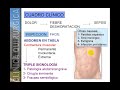 ABDOMEN AGUDO PERFORATIVO 2