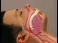 mechanical ventilation 2