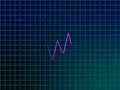 Electrocardiogram