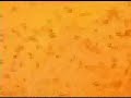 Thumbnail #1