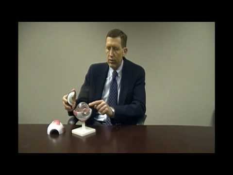 Diabetic Macular Edema
