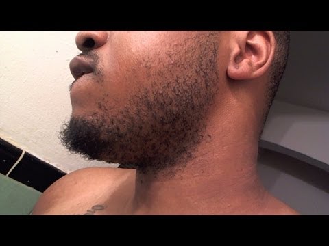 how to fasten beard growth