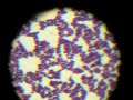 Gram positive Gram positive