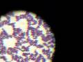 Gram positive