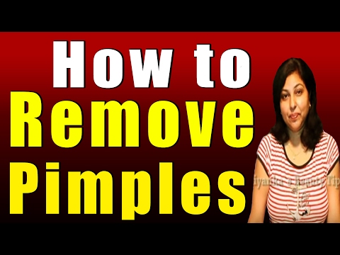 how to remove acne n pimple