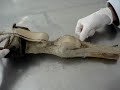 Anatomia 2 Anatomia 2