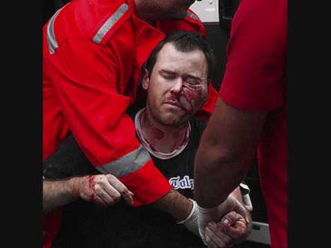 las peores faltas del futbol lesiones del futbol fracturas